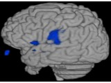 fMRI brain surface2