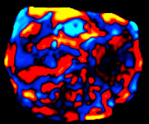 Wave Images Obtained by applying mechanical waves through the abdominal wall, while acquiring a motion-sensitive GRE sequence.