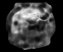 Stiffness Map Allows for quantitative calculation of tissue stiffness through a region of interest, in this case, l0.6 kiloPascals (kPa).